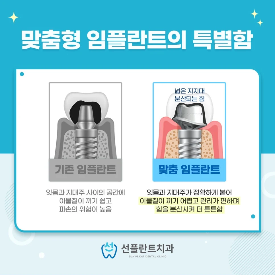 기존 임플란트와 맞춤 임플란트의 지대주 모양을 나란히 비교한 안내 그림